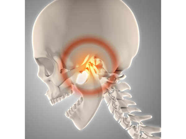 顎関節症の代表的な症状