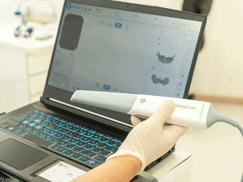 口腔内スキャナー(Aoral スキャン 3)